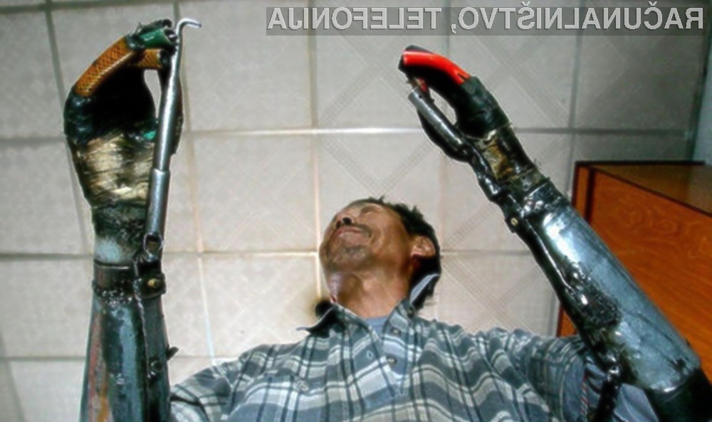 Doma izdelane bionične roke so možakarju znatno izboljšale kakovost življenja!