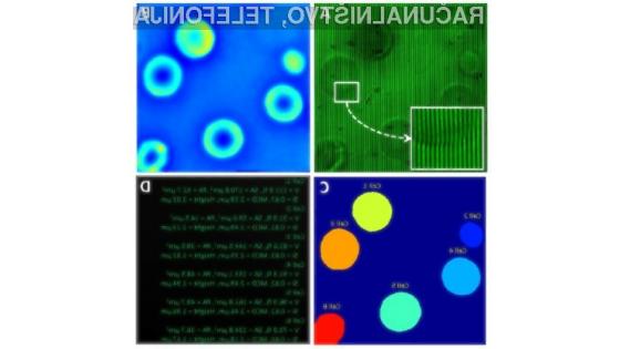 Digitalizacija hematoloških preiskav s pomočjo računalniško vodenih preiskav