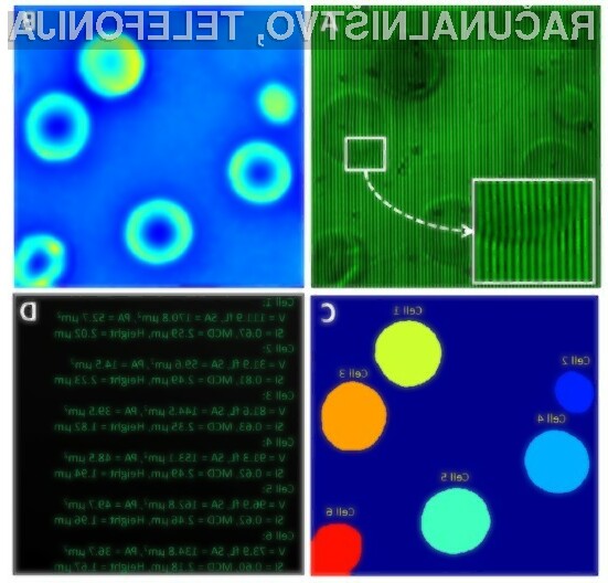 Digitalizacija hematoloških preiskav s pomočjo računalniško vodenih preiskav