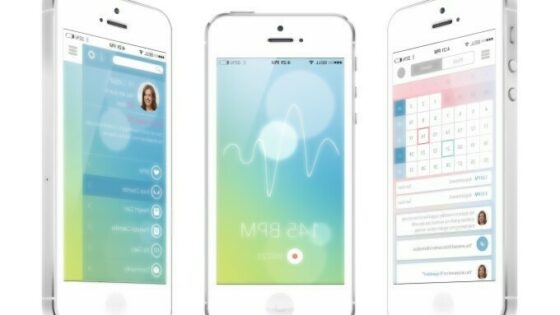 Za napredno rešitev Bellabeat naj bi se zanimalo celo podjetje Apple!