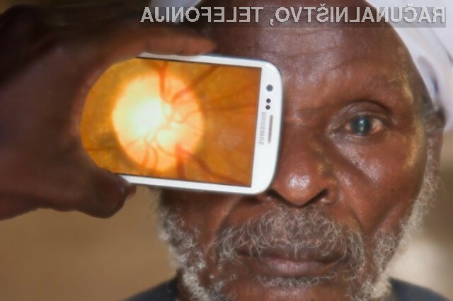 Za pregled očesa bo kmalu zadoščal le pametni mobilni telefon.