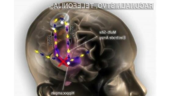 Elektronika naj bi pripomogla k boljšemu spominu ljudi!