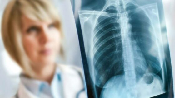 Umetna inteligenca bi že lahko nadomestila strokovno zdravstveno osebje