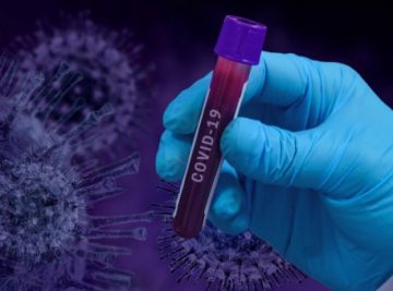 V raziskavi razširjenosti koronavirusa v Sloveniji sodeluje tudi FRI