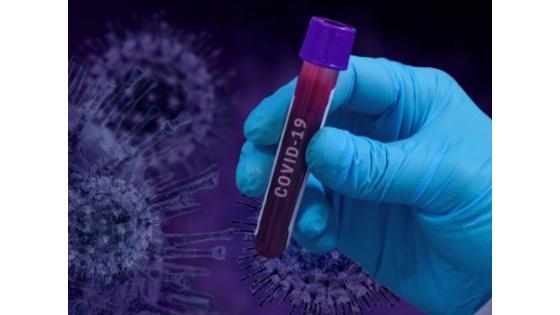V raziskavi razširjenosti koronavirusa v Sloveniji sodeluje tudi FRI